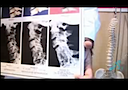 Intro to Chiropractic Care