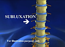 What is Chiropractic?